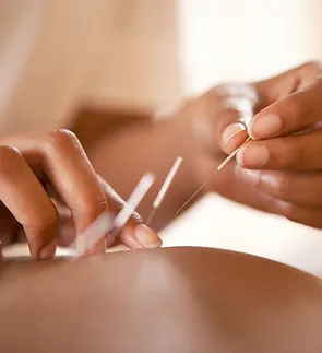 Semilla de Fertilidad - Centro de Acupuntura para la Fertilidad photo 1